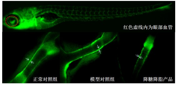 利用斑馬魚模型評價高血糖高血脂血管壁增厚改善功效